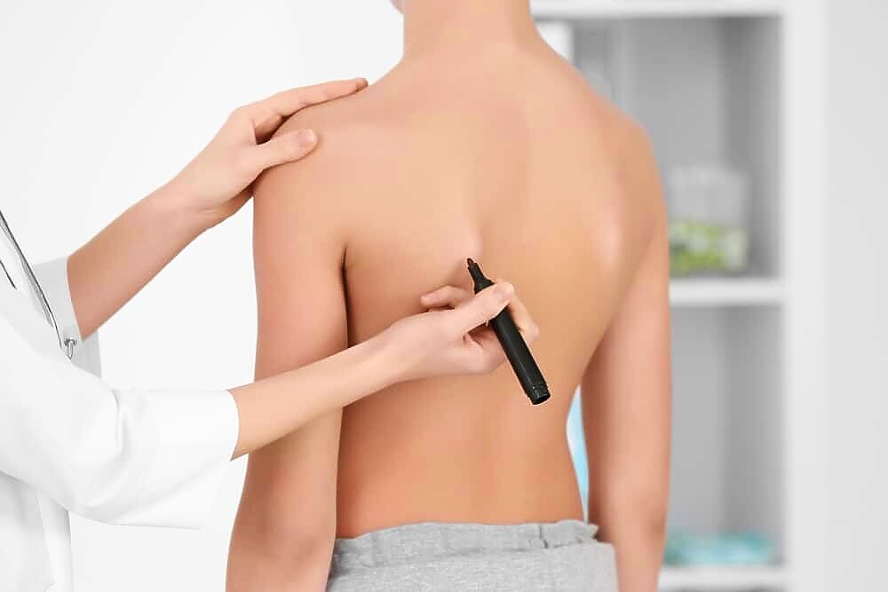 Terapia wad postawy — badanie skoliozy